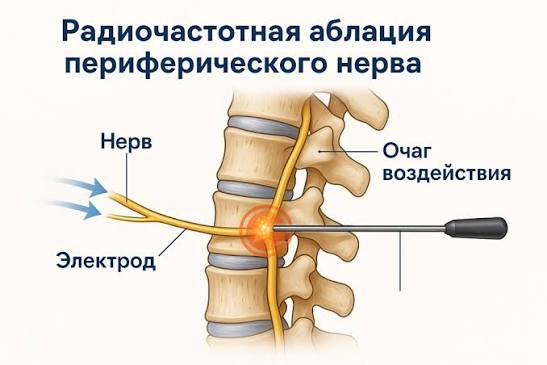 РЧД суставов и позвоночника