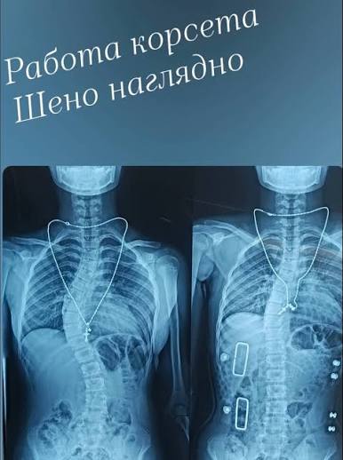 РЧД суставов и позвоночника